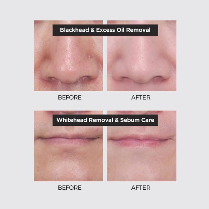 [Neogen] Pore Tight Peeling Mousse 80ml Poriënverzorging / Dode huidverzorging black