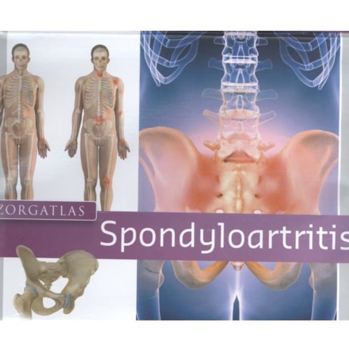 Zorgatlas Spondyloartritis - I.A.A.M. van Echteld