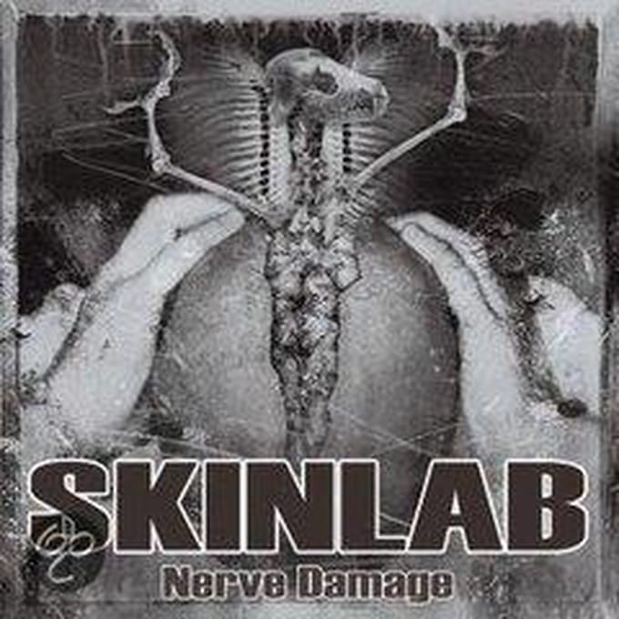 Nerve Damage