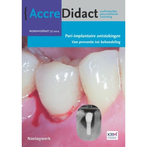 Peri-Implantaire Ontstekingen - Accredidact - Yvonne de Waal