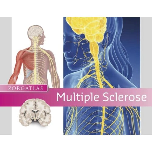 Multiple Sclerose - Zorgatlas - Leonieke Ravestein
