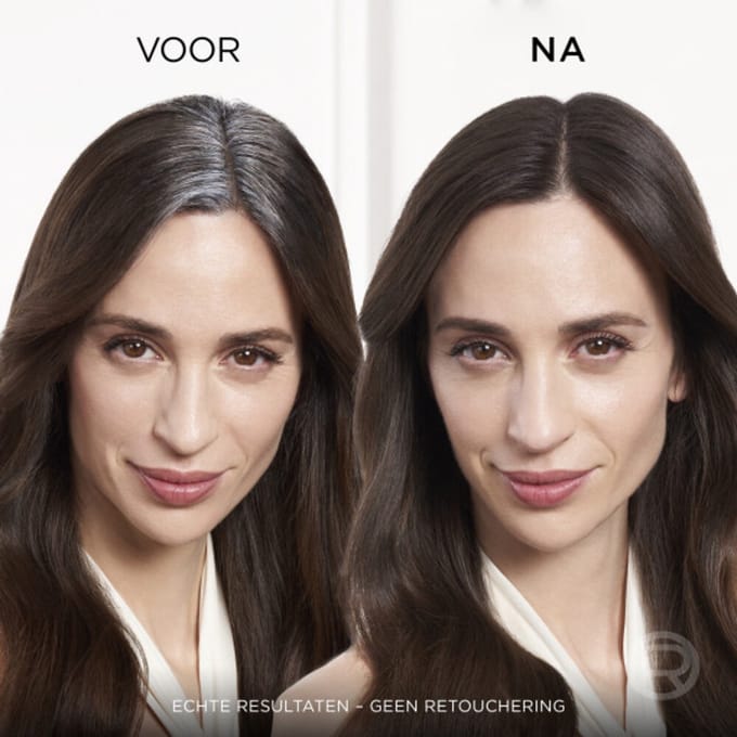 L'Oréal Magic Retouch Uitgroeispray Donkerblond - 3 x 75 ml - Voordeelverpakking