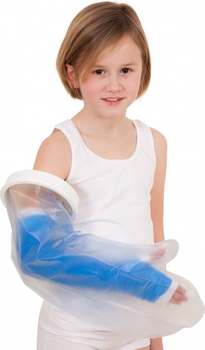 Gipsbeschermer heel arm kind