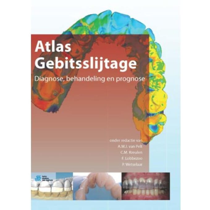Atlas Gebitsslijtage