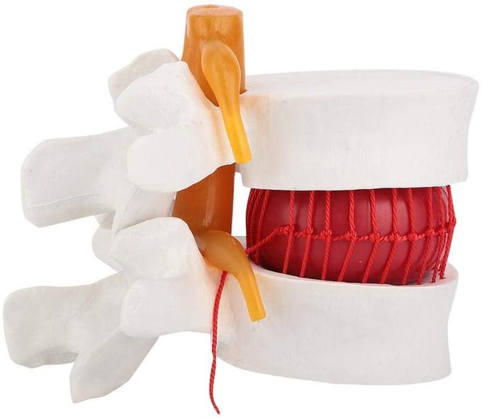 Lumbale Wervelkolom Model - Anatomisch Hulpmiddel - Studie Demonstratie - 1.5x Vergroting - 10 x 10 x 10 cm - Wit