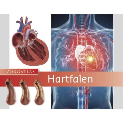 Hartfalen - Zorgatlas