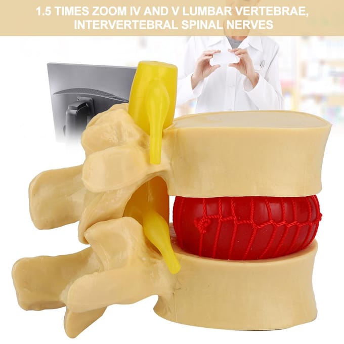1:1.5 Lendenwervelschijf Hernia Demonstratiemodel Studie Leer Menselijke Wervelkolom beige