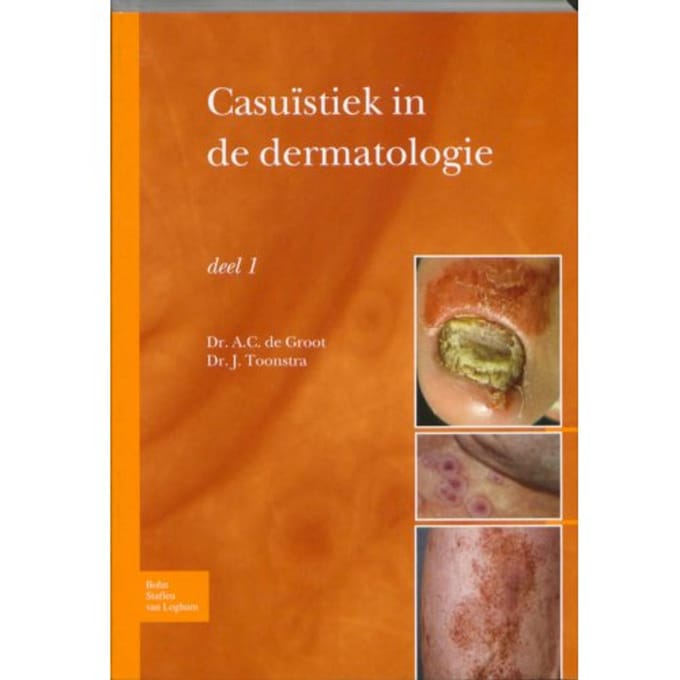 Casuïstiek In De Dermatologie / Deel 1 - A.C. de Groot