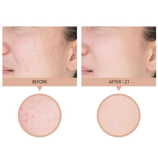 Genoeg Premium Ultra X10 Cover Up Collagen Foundation 100ml (9 Opties) 21