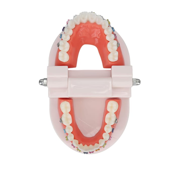 Modèle de dents typodont dentaire avec bracket métallique orthodontique pour enseignement et recherche dentaire white