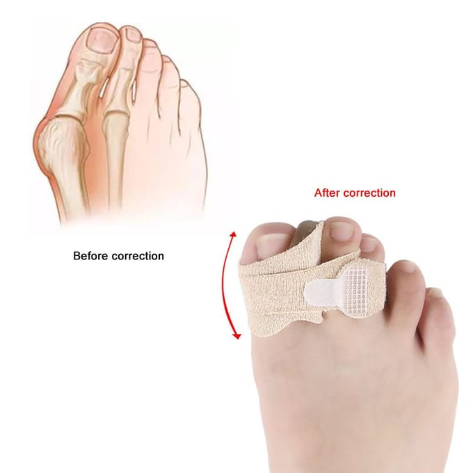 Hammer Toe Straightener Toe Wraps Splint to Realign Hammer Toe Overlapping Toe and Crooked Toes beige