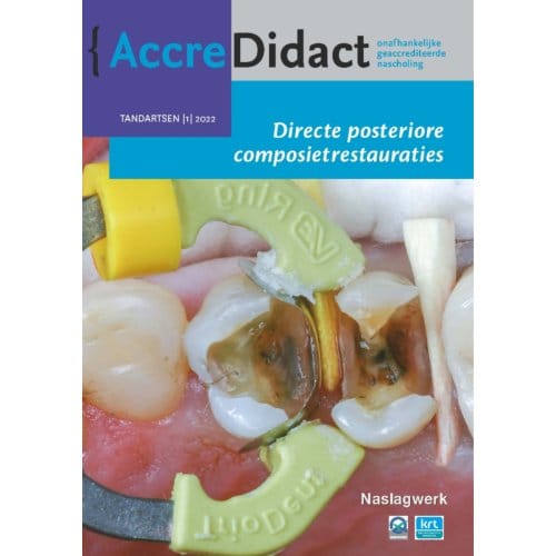Directe Posteriore Composietrestauraties - Accredidact - Bas Loomans