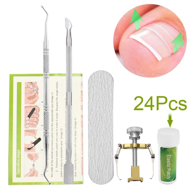 Teennagelcorrectieset Teennagelbehandeling Teennagel rechttrekken Patch Lifter Fixer Recover 01(12pcs) white