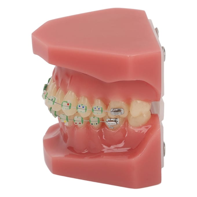 Modèle de démonstration orthodontique dentaire Modèle de dents avec fils métalliques et bracket pour l'enseignement brown