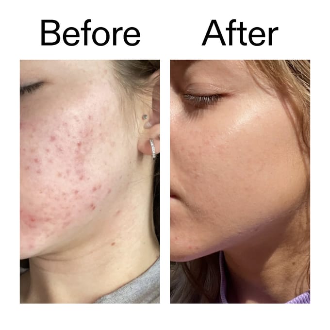 The INKEY List Niacinamide Serum 30 ml