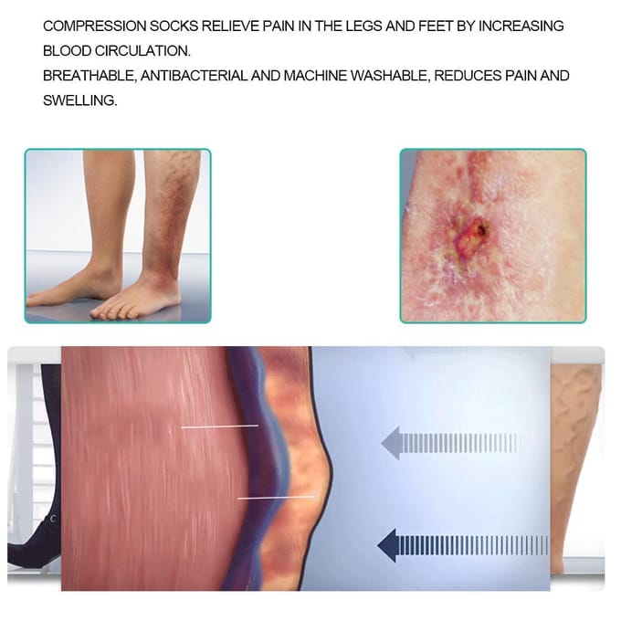 Bas de Compression Médicaux Élastiques Bas pour Varices Amincissement des Jambes XL