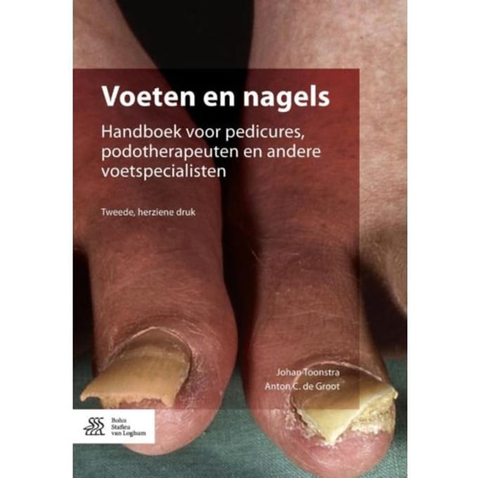 Voeten En Nagels - Johan Toonstra
