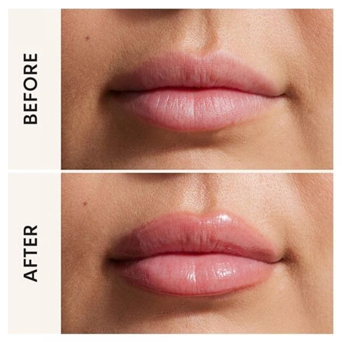 Lip Filler Volumizing Lipgloss #001-baby 5 ml