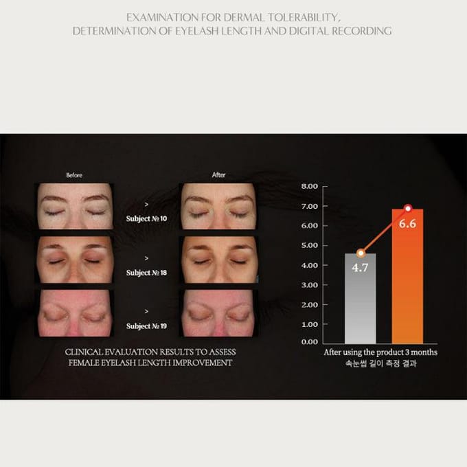 [ROOTON] Alpha Erguen Eyelash Serum 5ml