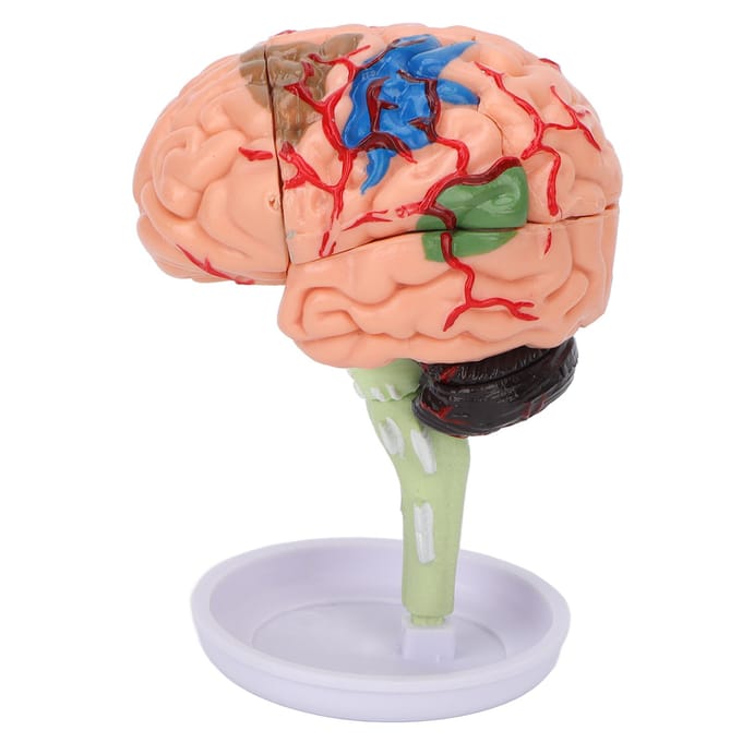 4D Anatomisch Hersenen Gemonteerd Model Duidelijke Structuur Vinyl Simulatie Hersenen Model om te Leren beige