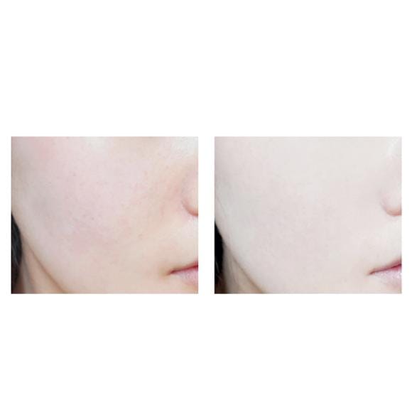 It's Skin Secret Solution Robe de Mariée Crème Blanche, 100Ml 3PCS
