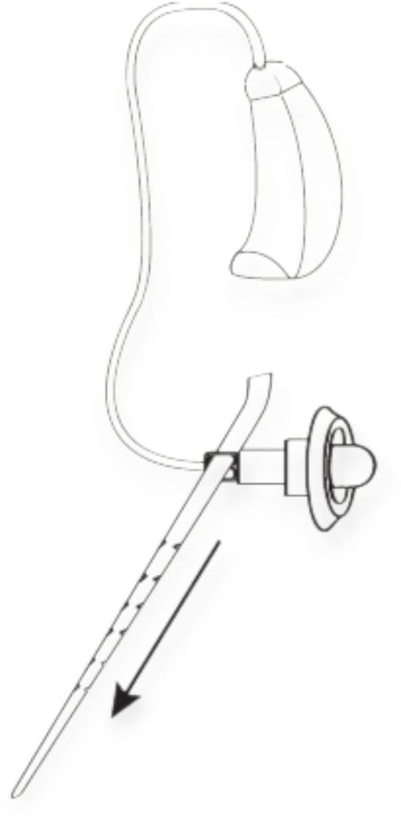 Widex Anchor RIC per 20 stuks