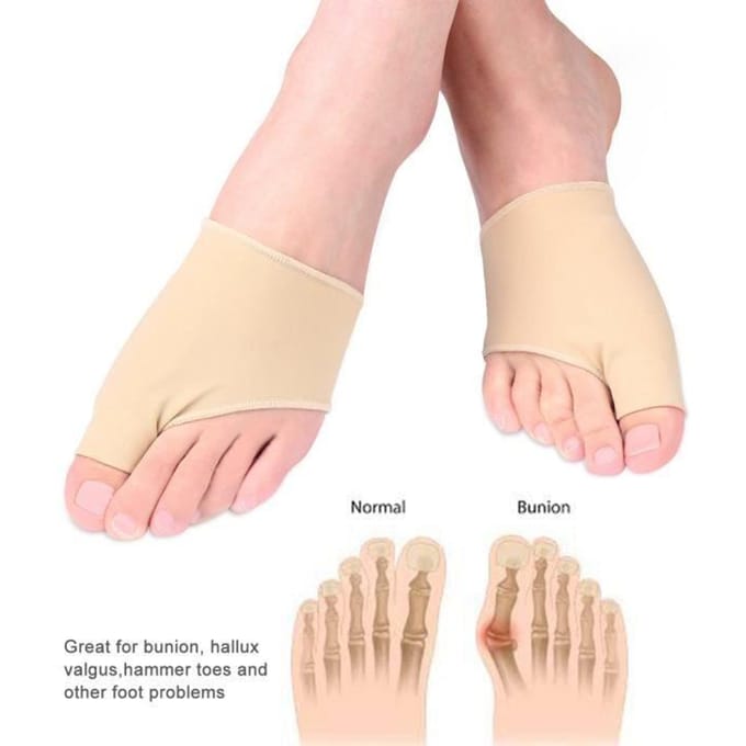 Orthèses Hallux Valgus ZERONE - Protection et correction des oignons - Traitement des orteils en marteau
