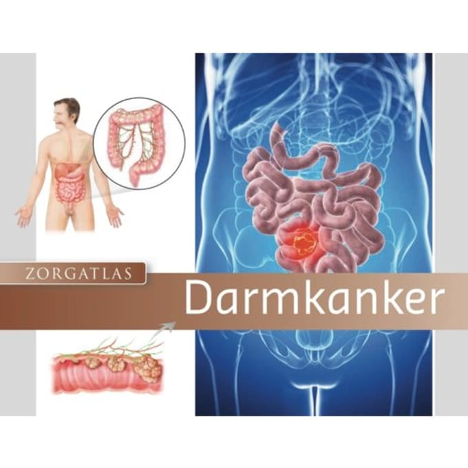 Zorgatlas Darmkanker - Zorgatlas - Riëtte Ruijten-Driessen
