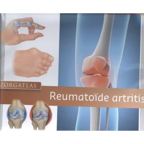 Zorgatlas Reumatoïde Artritis - Inger Meek