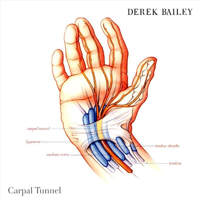 Carpal Tunnel