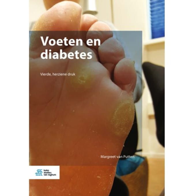 Voeten En Diabetes - Margreet van Putten