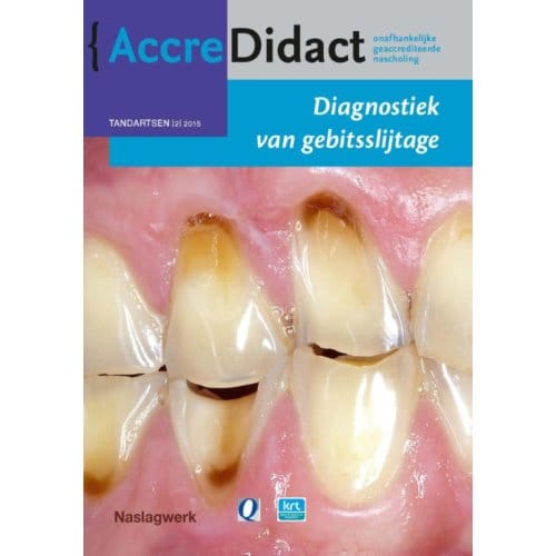 Diagnostiek Van Gebitsslijtage - Accredidact - Peter Wetselaar