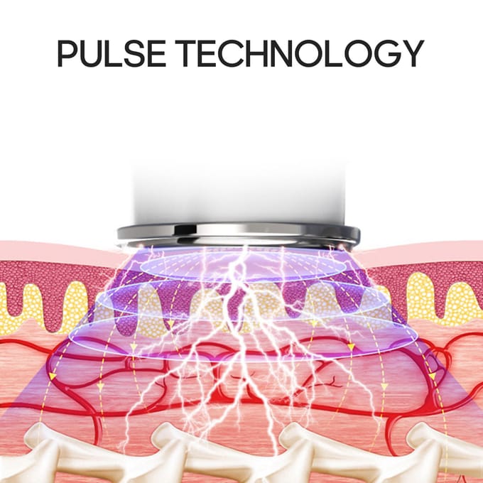 4-koppige cervicale wervelkolomstimulator Krachtaanpassing USB oplaadbare intelligente pulsverwarming nek wit