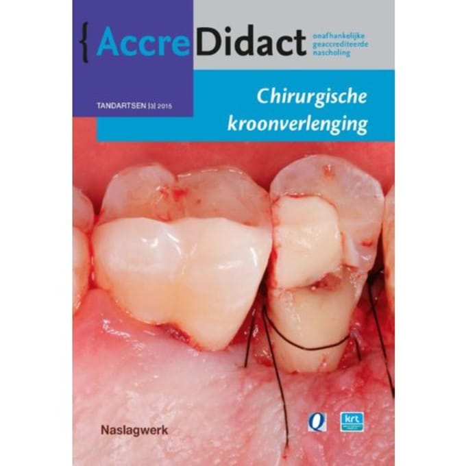 Chirurgische Kroonverlenging - Accredidact - S. Paraskevas