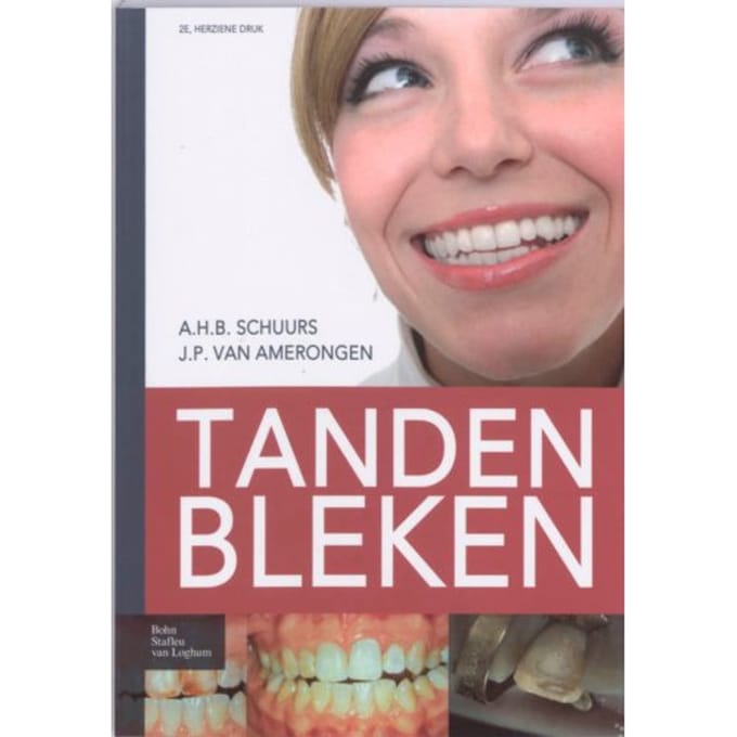 Tanden Bleken