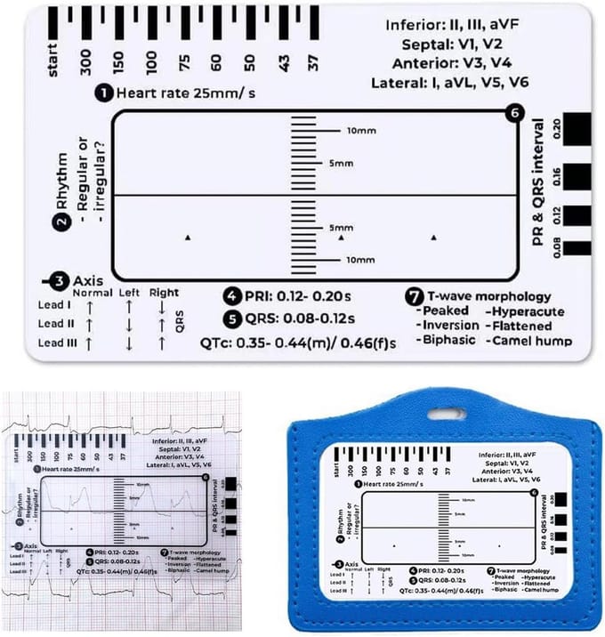 ECG Meetinstrument - Hartslag Meter - Snelle Analyse - 7-Staps Interpretatie - ID Kaart Formaat - Transparant