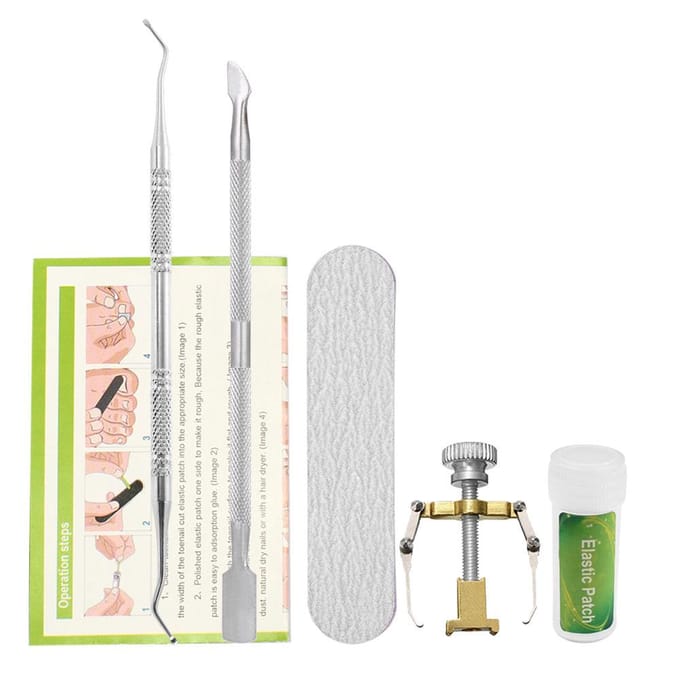 Teennagelcorrectieset Teennagelbehandeling Teennagel rechttrekken Patch Lifter Fixer Recover 01(12pcs) white