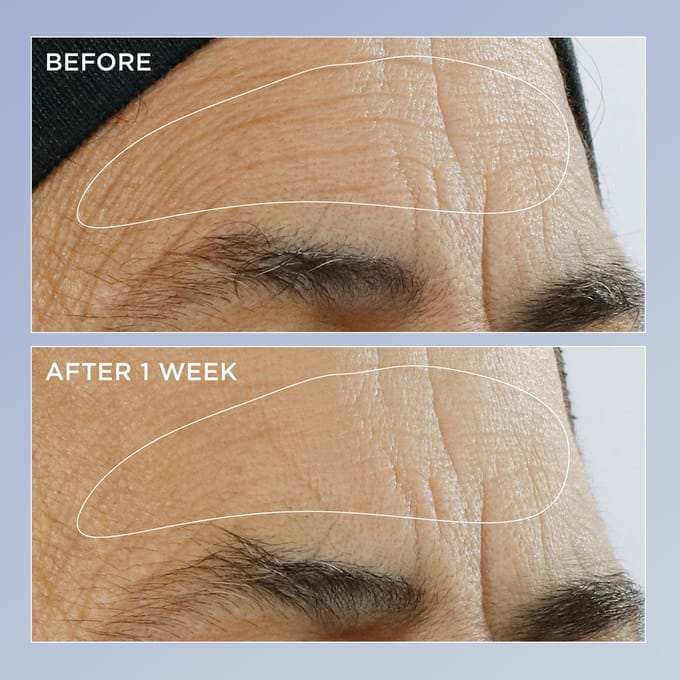 Perricone MD Triple Retinol Renewal Duo