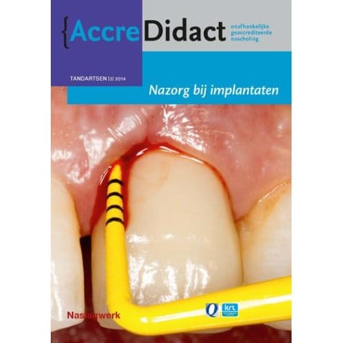 Nazorg Bij Implantaten - Accredidact - Gordon van der Avoort
