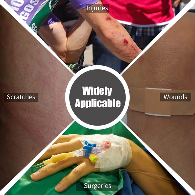 Arm Gipshoes Volwassene Waterdicht Herbruikbaar Been Hand Voet Enkel Knie Gips Foot white