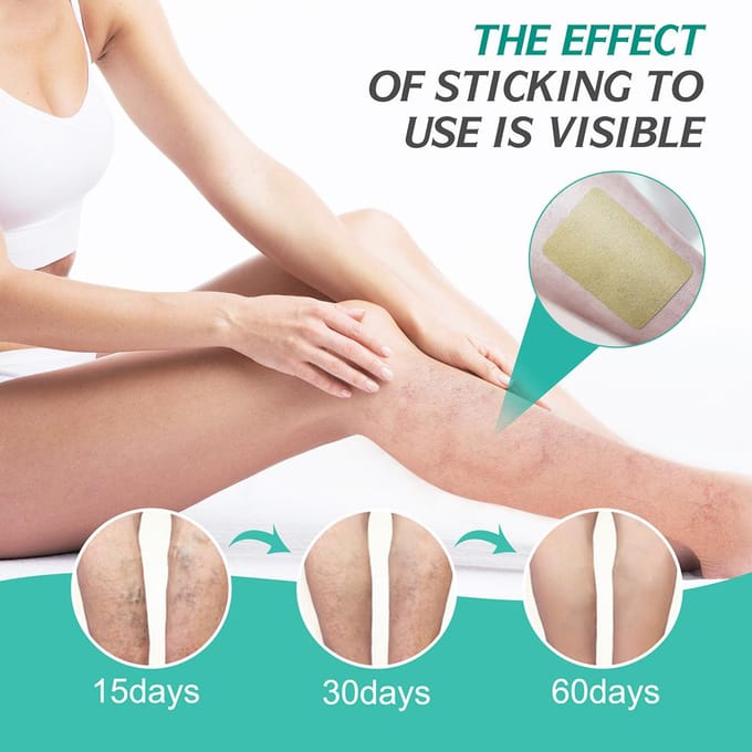 8 stuks spataderpleisters vasculitis flebitis spinaderen stickers voor spataderen spinaderen beige