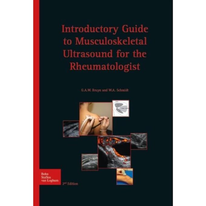 Introductory Guide To Musculoskeletal Ultrasound For The Rheumatologist - G.A.W. Bruyn