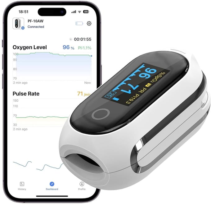 Vibeat Bluetooth Saturatiemeter – Herlaadbare Vingeroximeter met 12 sets Geheugen en Continue Meting