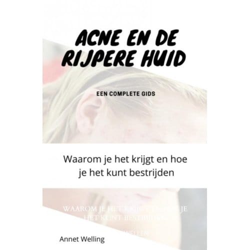 Acne Bij Volwassenen - Annet Wellen