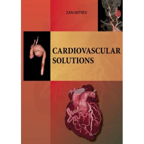 Cardiovascular Solutions - Zan Mitrev