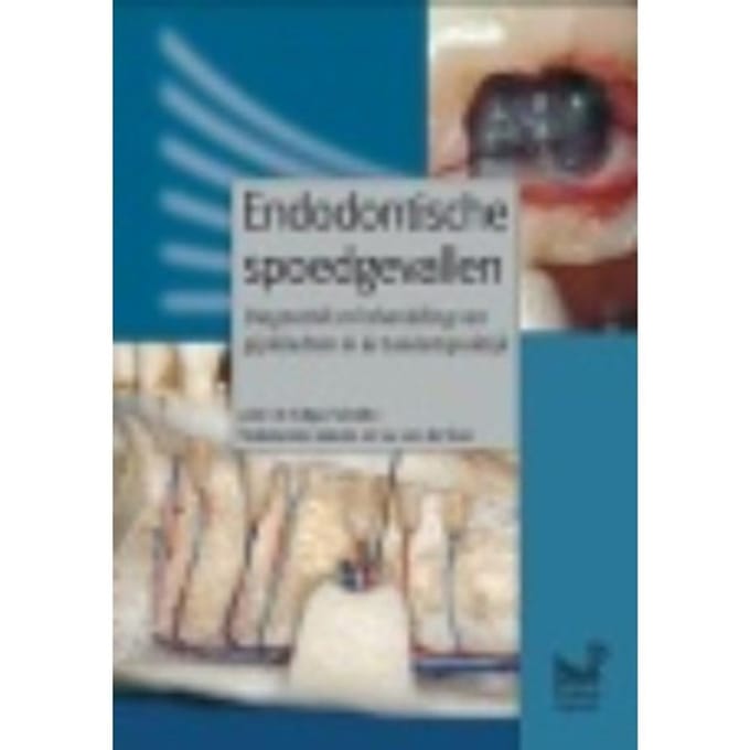 Endodontische Spoedgevallen - Edgar Schäfer