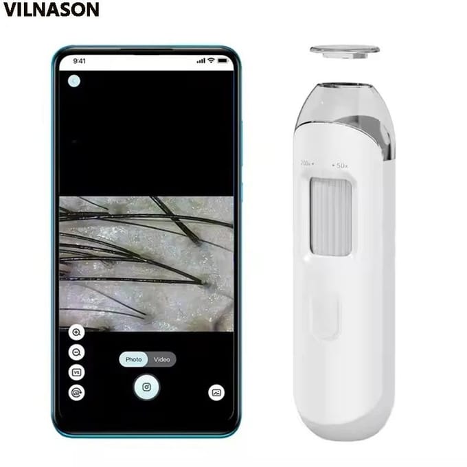 Electronische Dermatoscoop Hoofdhuid Camera Detectie Professionele Gezichtshuid Analyzer Machine Digitale Microscoop Poriën Vergrootglas NIEUW white