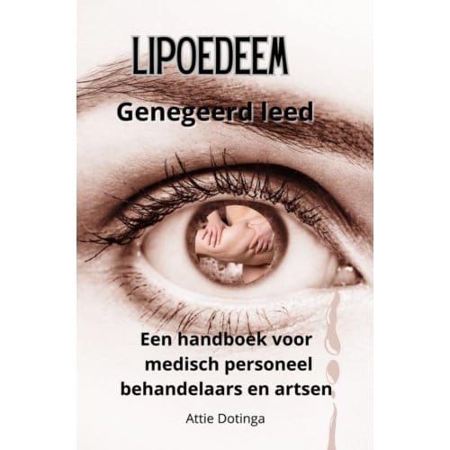 Lipoedeem - Attie Dotinga