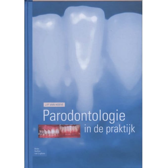 Parodontologie In De Praktijk - J.P. van Hoeve
