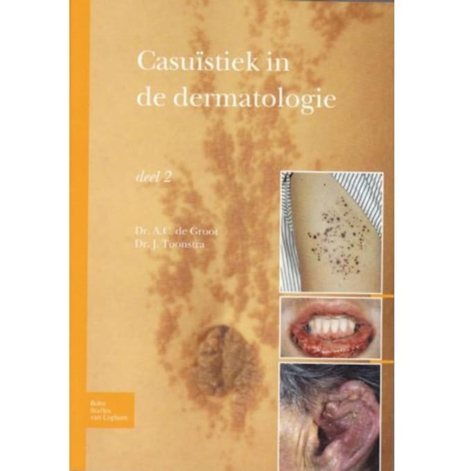 Casuïstiek In De Dermatologie - Johan Toonstra